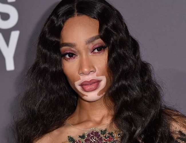 Discover Winnie Harlow's Fashion Preferences and Influences
