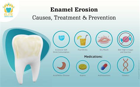  Common Interpretations of Expelling Deteriorating Enamel in Dreamland 