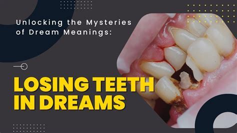  Debunking Superstitions: Unraveling the True Meaning of Dreaming of a Fractured Tooth without Bleeding 