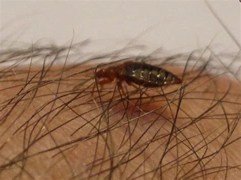 A Dream That Shook Me: A Creeping Insect on My Scalp