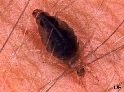 A Silent Epidemic: The Prevalence of Lice in Adults