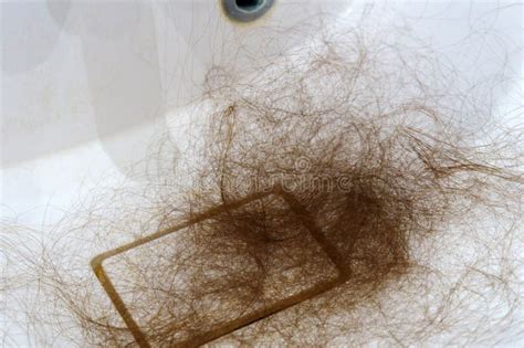 A Woman's Struggle: Confronting an Unwanted Hair Loss Issue