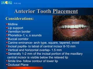 Aesthetic considerations: Preserving a wobbly anterior incisor