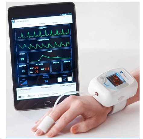 Alternative approaches to monitoring blood pressure using wearable devices