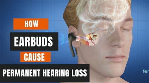 Common Causes of Indiscernible Speech in Earphones