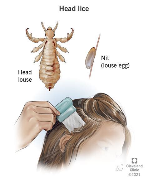 Common Emotions Associated with Dreaming of Lice