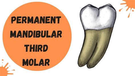 Common Themes and Patterns in Dreams about Third Molars