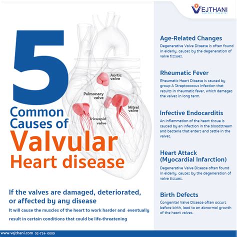 Common causes of the issue