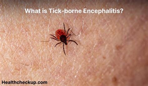 Coping Strategies: Conquering the Fear of Tick-Borne Encephalitis