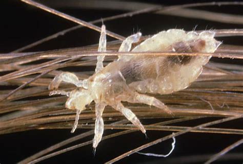 Decoding the Significance of Lice in Your Dreams