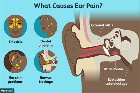 Discomfort and Pressure on Ears