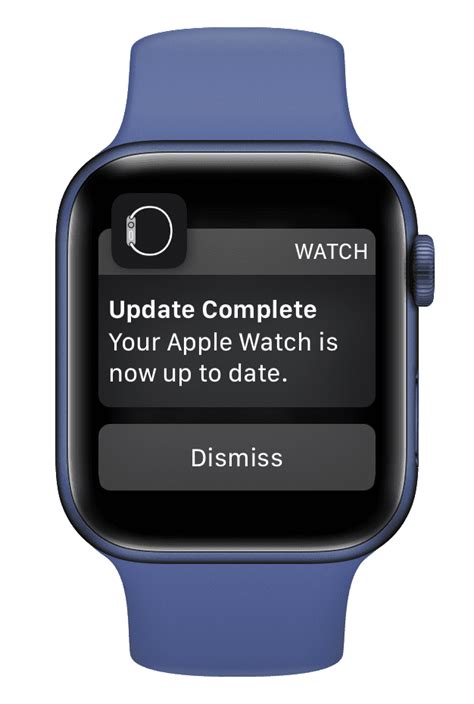 Discover the Latest Enhancements and Features of the Apple Watch Update