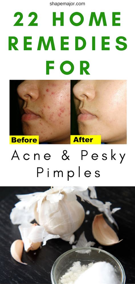 Effective Home Remedies for Pesky Blemishes