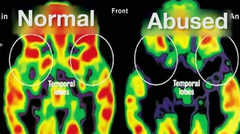 Emotional Impact: How a Blaze Vision Reflects the Trauma Endured by Survivors