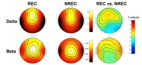 Enhancing Sleep Quality and Enhancing Dream Recall through Electrode Stimulation