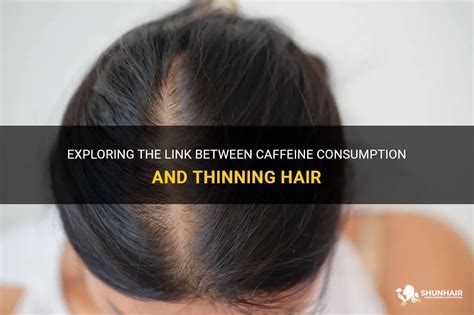 Exploring Possible Causes of Hair Thinning Dreams in the Transition from Thursday to Friday