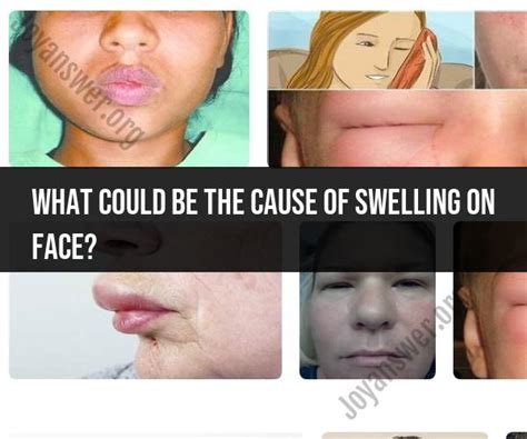 Exploring Swollen Cheeks: Possible Triggers and Effects