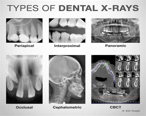 Exploring the Different Varieties of Dental Vision and their Significance