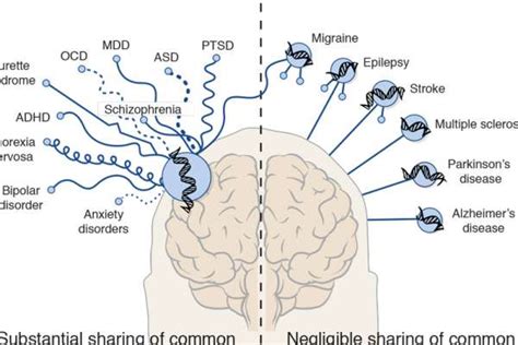 Exploring the Link: Sleep Disorders and Brain Tumors