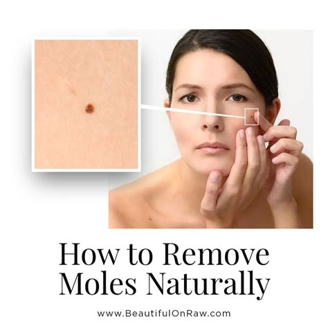 Exploring the Meaning Behind Mole Removal Dreams