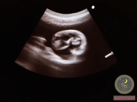 Exploring the Meaning of Dreaming about the Demise of an Unborn Offspring