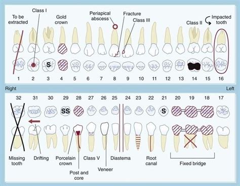 Exploring the Psychological Significance of a Child's Vision Regarding an Absent Tooth