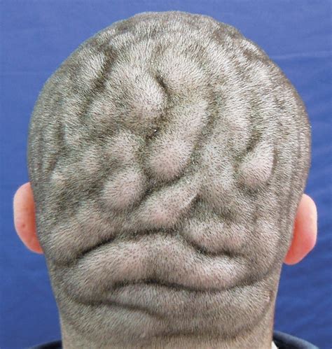 Exploring the Symbolic Significance: Bald Patch on a Woman's Scalp in Dream Interpretation