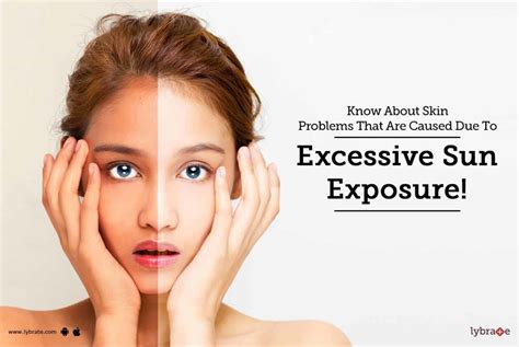 Exposure to Excessive Brightness