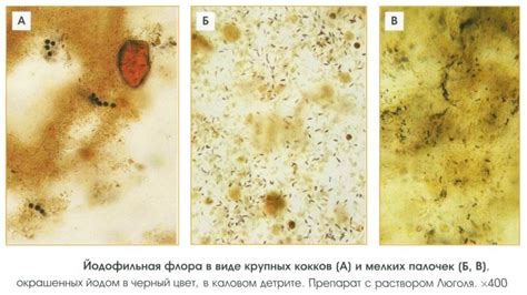 From the Subconscious to Reality: My Vision of Fecal-shaped Iodophilic Flora