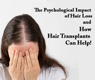 Hair Loss and its Psychological Impact on Females