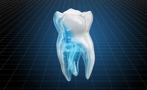 Making Sense of Dental Imagery in Dreams