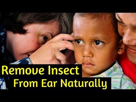 Medical Procedures for Removal of Insects from the Ear