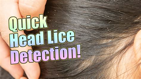 Methods for Detecting Lice Infestations in Kids