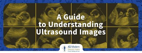 Methods for Interpreting and Understanding Dreams Related to a Baby Ultrasound