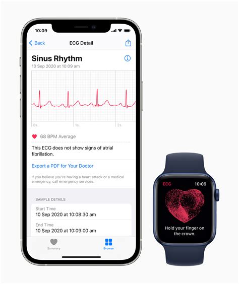 Overview of the ECG feature on Apple Watch 7