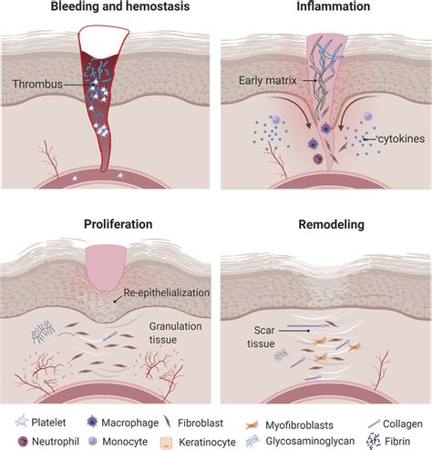 Physical Consequences: The Wound and Its Healing Process