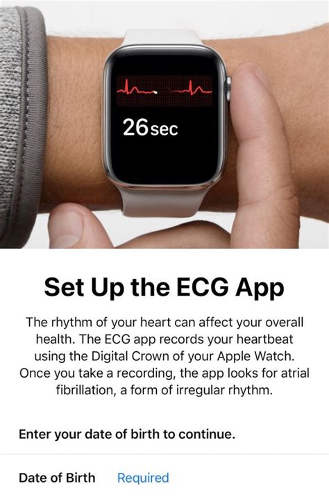 Potential Benefits and Limitations of ECG Feature on Apple Watch Series