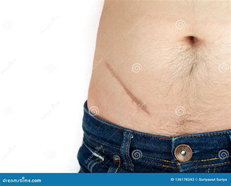 Practical Tips for Interpreting Your Abdominal Scar Dreams