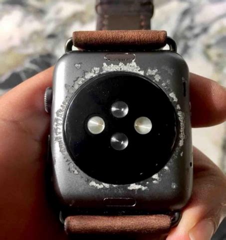 Preventing Sweat Damage on Your Apple Watch Band