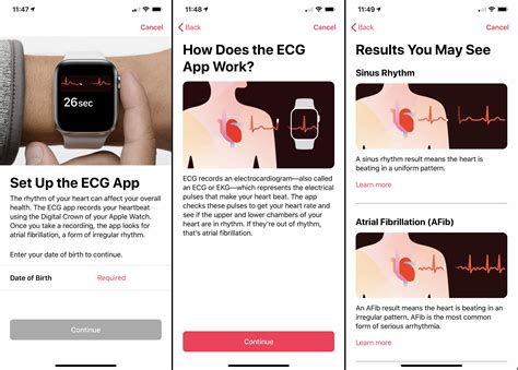 Process of taking an ECG using Apple Watch 7