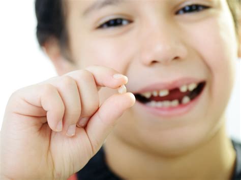 Professional Advice: Dentists' Perspective on Front Teeth Loss in Children