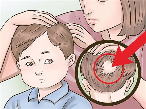 Professional Treatments for Hair Loss in Children