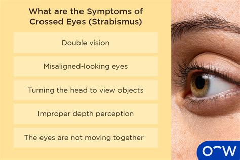 Psychological Insights into the Meaning of Strabismus in Dreams