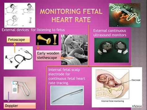 Recognizing the Placement of the Heart Rate Sensor