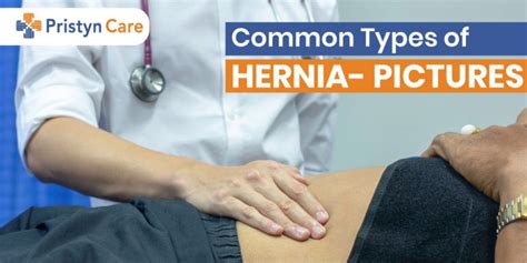 Recognizing the Symptoms: How to Identify a Hernia