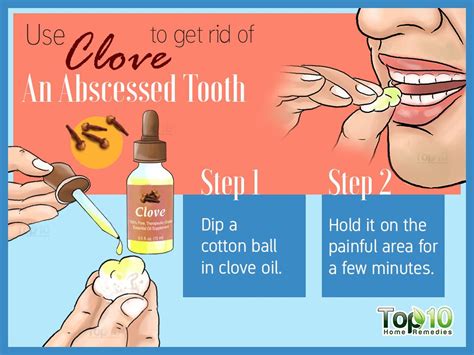 Relieving Tooth Pain at Home: Natural Remedies and Helpful Tips