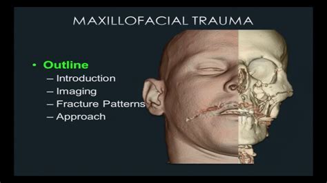 Revealing the Veiled Communication Behind Facial Traumas