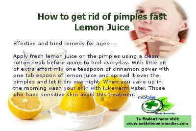 Say Goodbye to Pimples with the Magic of Lemon Juice