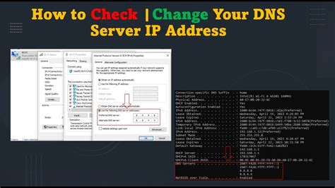 Setting Up IP Addresses and DNS