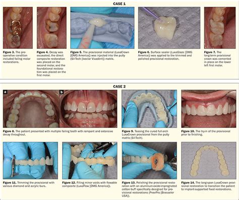 Step 7: Finalize the Restoration Procedure